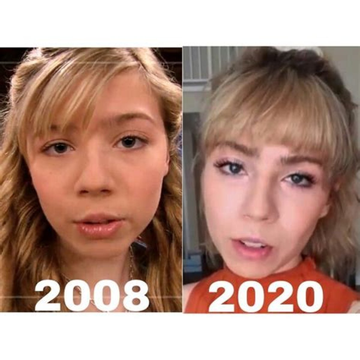 Jennette McCurdy Plastic Surgery Before and After