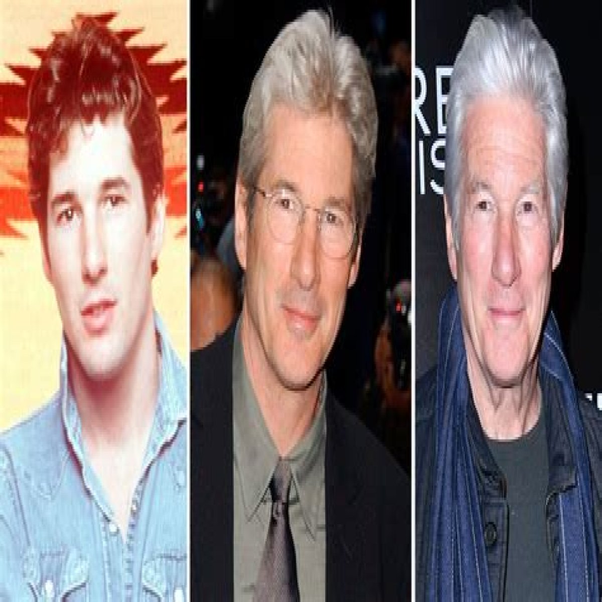 Richard Gere Plastic Surgery Before and After