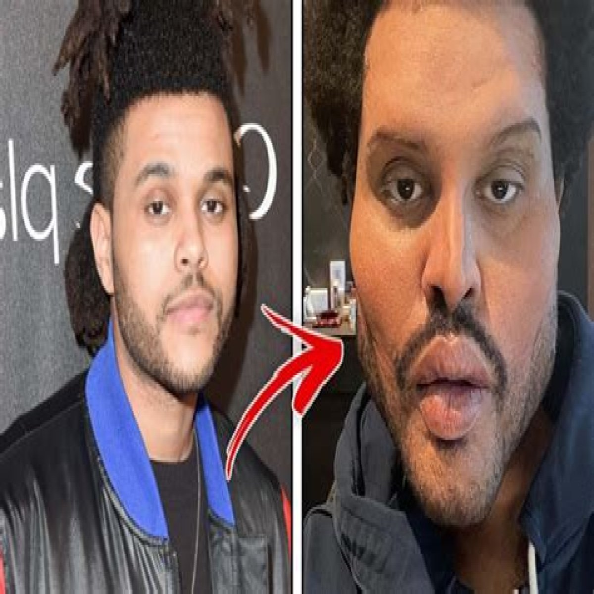 This Actor is Unrecognizable After His Plastic Surgery